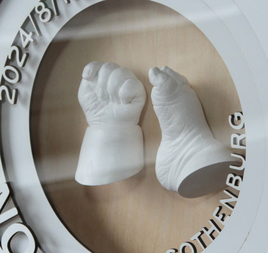 Alginatgjutning av en nyfödd bebis hand